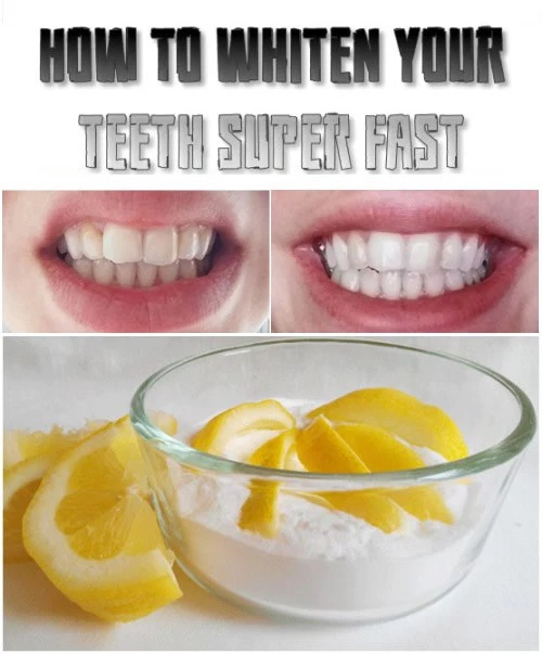 How to whiten your teeth super fast FITNESS SHORTCUT