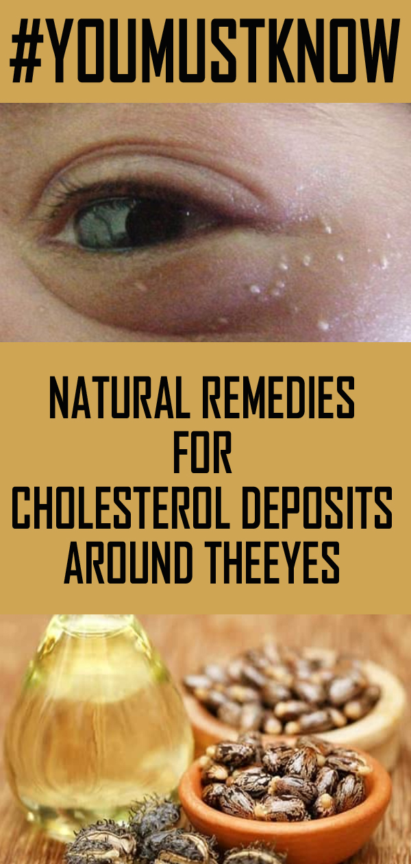 CAUSES AND NATURAL REMEDIES FOR CHOLESTEROL DEPOSITS AROUND THE EYES