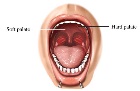 Mouth Pallate 35