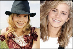 braces before celebrities emma watson teeth celebrity hermione faces famous smiles invisalign face dental brace harry veneers smile ceramic celebs