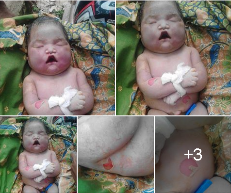 Kisah Memilukan Ibu Yang Melahirkan Bayi Meninggal Dalam Kandungan Kisah Memilukan Ibu Yang Melahirkan Bayi Meninggal Dalam Kandungan