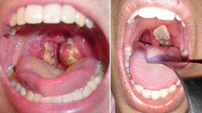 Perawat Okupasi 2017