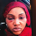 Mercy Aigbe’s Battered Face And The Reactions