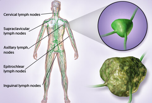 lymphoma treatment cost why patients come from sudan angola and congo for lymphoma treatment in india indo lymphoma treatment cost why patients come from sudan angola and congo for lymphoma treatment in india indo