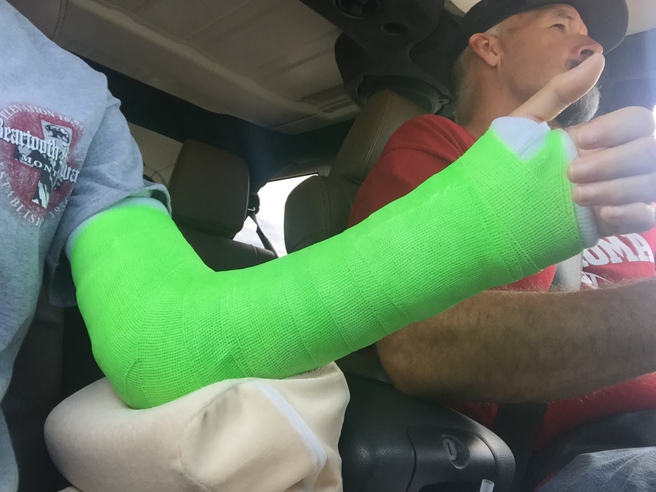 A Day in the Life of a Farm Wife Update on the Broken Arm