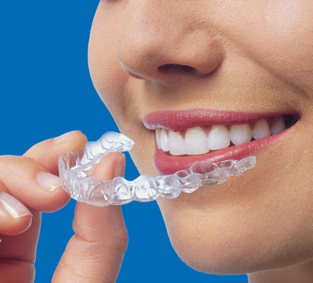 invisalign melbourne invisalign melbourne