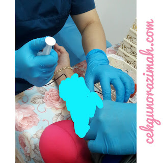 rawatan prp, dr. mad wellness, terapi prp, platelet rich plasma, rawatan kecantikan prp rawatan prp, dr. mad wellness, terapi prp, platelet rich plasma, rawatan kecantikan prp