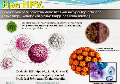 Image Tanda Terinfeksi Penyakit HPV