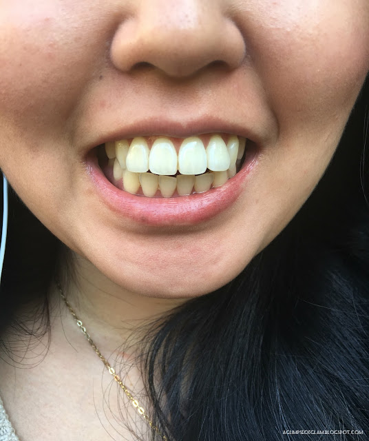 Smile Brilliant Teeth Whitening Review - Andrea Tiffany A Glimpse of Glam Smile Brilliant Teeth Whitening Review - Andrea Tiffany A Glimpse of Glam
