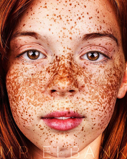 Freckles: verdadera belleza detrás pecas