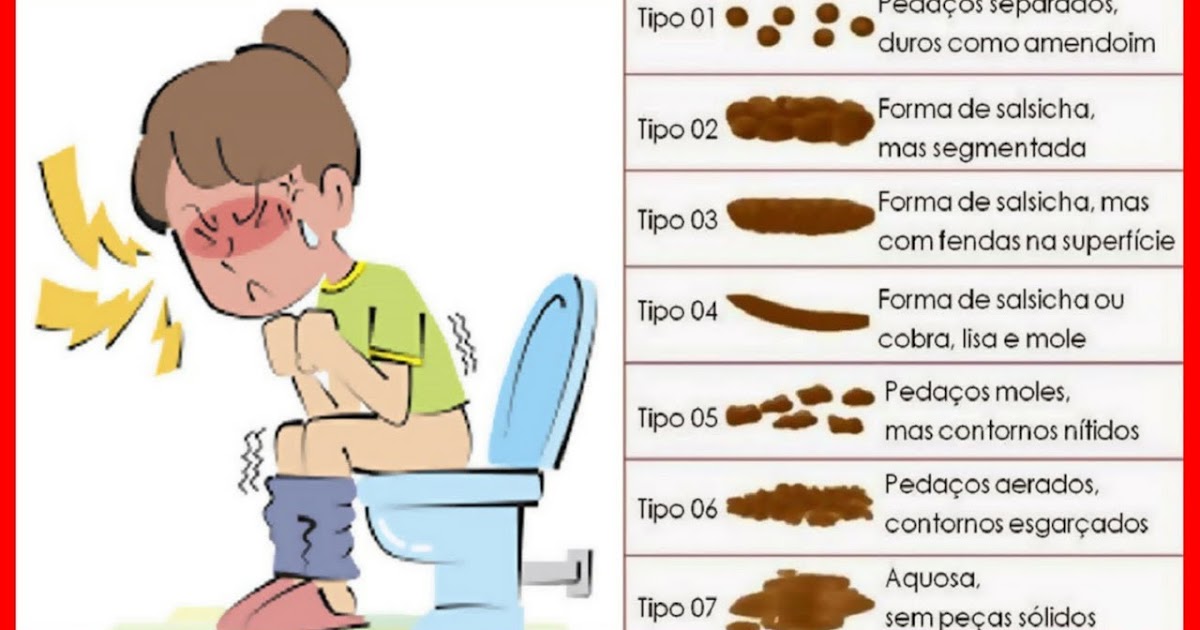 Resultado de imagem para tipos de fezes