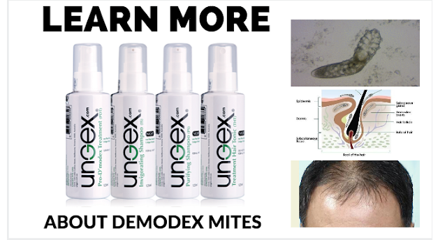 Demodex Symptom