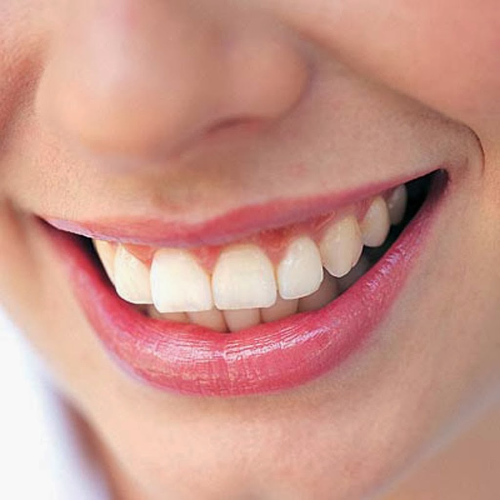 妙齡女潔牙美齒DIY 反招酸痛敏感