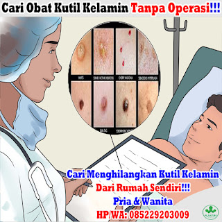 Obat Kutil Kelamin, Cara Mengobati Kutil Dikemaluan Kelamin Dari Rumah Sendiri, Dokter Obat Kutil Kelamin Terbukti Terbaik Dan Terpercaya