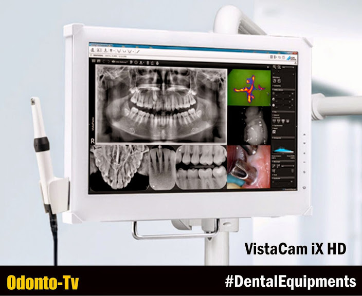 DENTAL EQUIPMENTS VistaCam iX HD