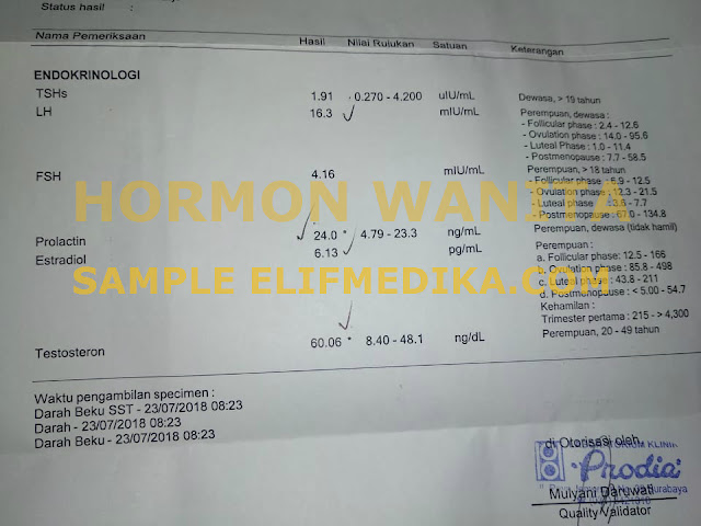 Hasil Tes Hormon Wanita Lengkap : Laboratorium Prodia Hasil Tes Hormon Wanita Lengkap : Laboratorium Prodia