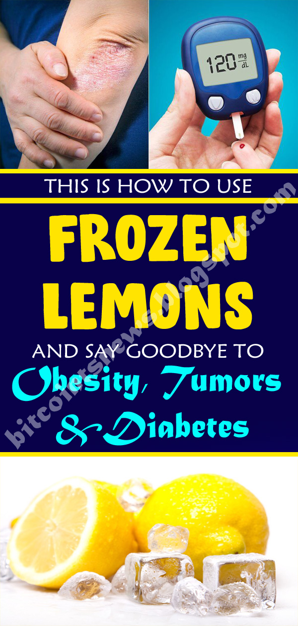 This Is How To Use Frozen Lemons and Say Goodbye to Diabetes, Tumors