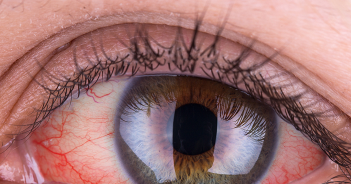 Ever wondered why your eyes look red in photographs?