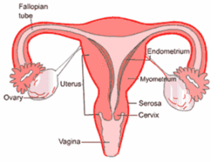 pengobatan hiperplasia endometrium tanpa kuret