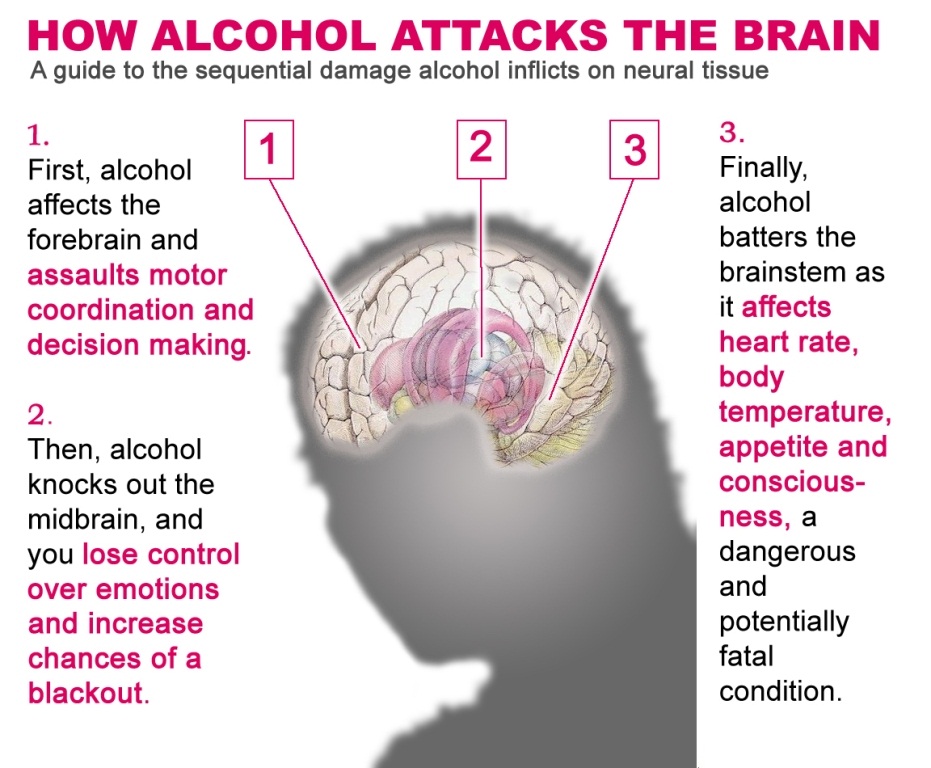 SURREAL ABERRANT Alcohol Should I Should I Not surreal-aberrant-alcohol-should-i-should-i-not