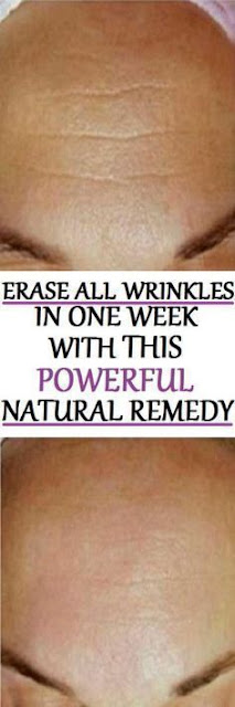 Powerful Natural Remedy That Eliminates All Wrinkles in One Week!