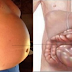 Primary Causes Why We Have A Bloated Tummy! Warning Signs You Shouldn't Ignore!