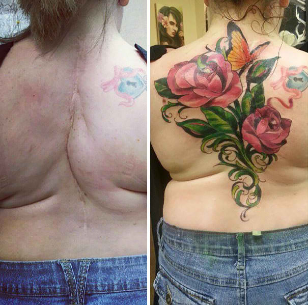 LOOK: Tattoo Artists Create A Masterpiece By Covering Up These Huge Scars With A Stunning Tattoo! LOOK: Tattoo Artists Create A Masterpiece By Covering Up These Huge Scars With A Stunning Tattoo!