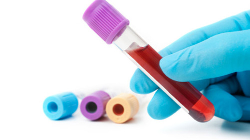 valores normales de pcr y vsg en adultos valores normales de pcr y vsg en adultos
