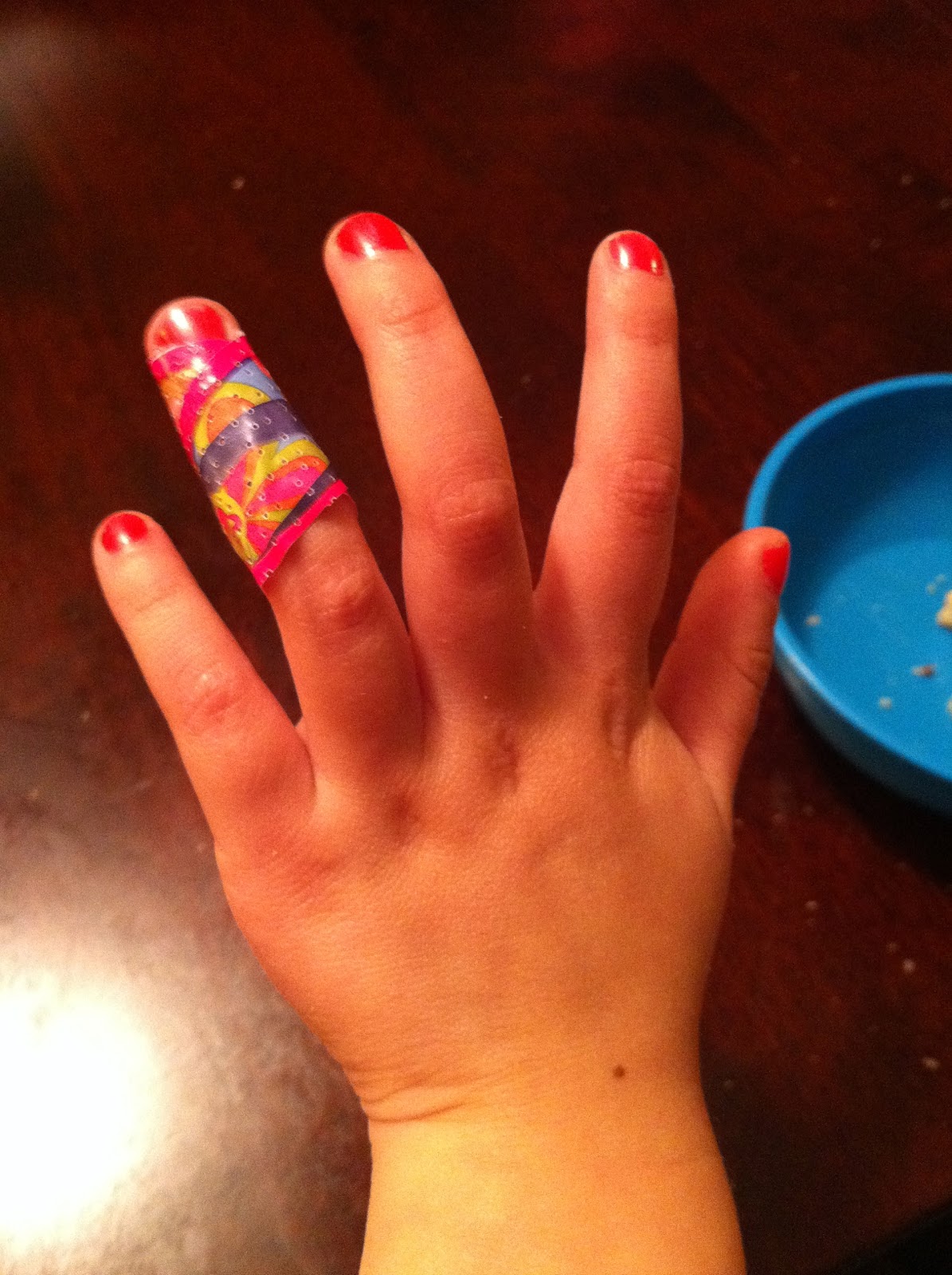 Completely Random and Awesome Thoughts Major Injury, Not Really