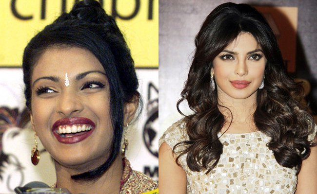 Bollywood Actresses Shocking Photos Before And After