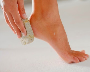 Tips Mengatasi Kaki Pecah-Pecah dengan Gula Merah Tips Mengatasi Kaki Pecah-Pecah