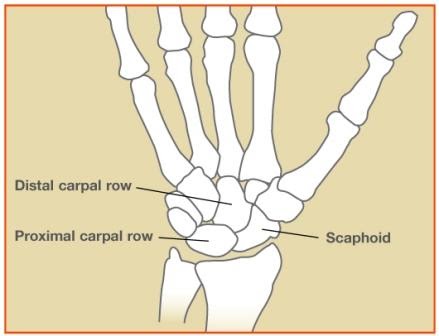 scaphoid pain but no fracture scaphoid pain but no fracture