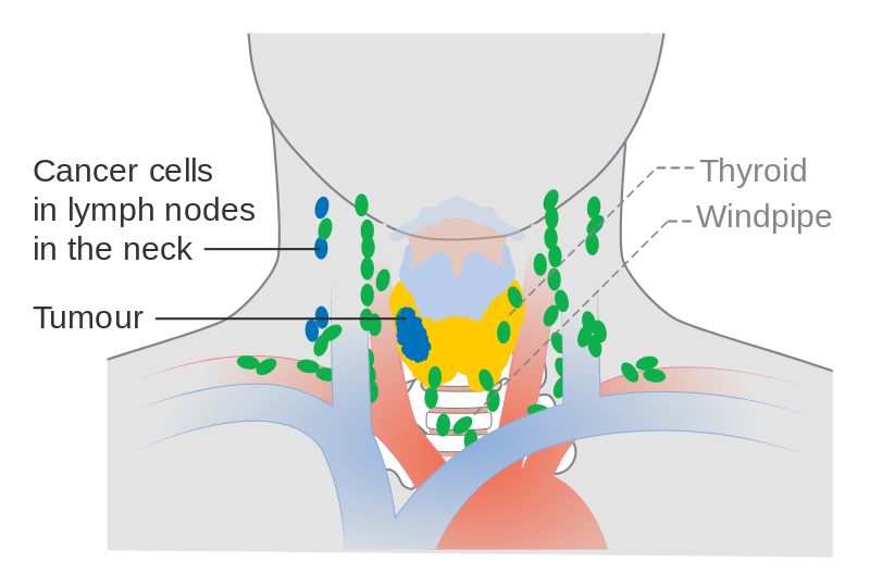 7 levels of lymph nodes in neck