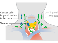 Diagram Of Lymph Nodes In Neck Diagram Of Lymph Nodes In Neck