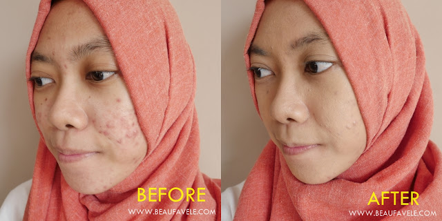 before after Pixy Make it Glow Dewy Cushion