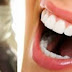 (ΚΟΣΜΟΣ)Αγγλία:Το πιο βρώμικο οδοντοιατρείο Τρέχουν τώρα οι ασθενείς να κάνουν εξετάσεις για μεταδοτικά νοσήματα 