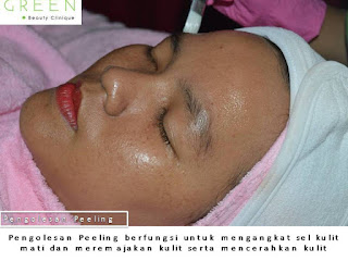 Proses dan biaya perawatan wajah di Green Beauty Clinique Tanjungpinang