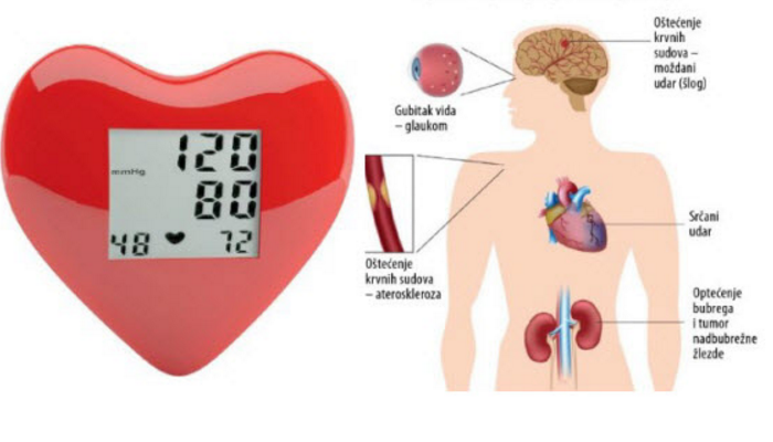 slika hipertenzija je ne moze)