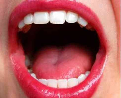 Your tongue is germ free only if it is pink