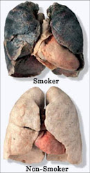 Smoking Lungs and Heart
