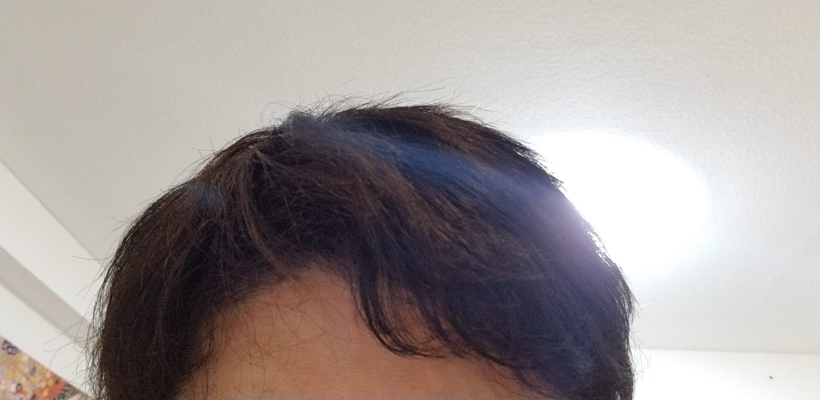 劇的改善 オクトセラピアシャンプーとビタミンaとかで乾性フケに1か月立ち向かった結果 タログタログ