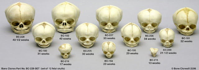 Baby Skull Development 6 Months: Understanding Your Baby’s Growth