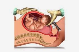 Berapa Lama Tempoh Sembuh Dari Luka Bersalin C Section Berapa Lama Tempoh Sembuh Dari Luka Bersalin C Section