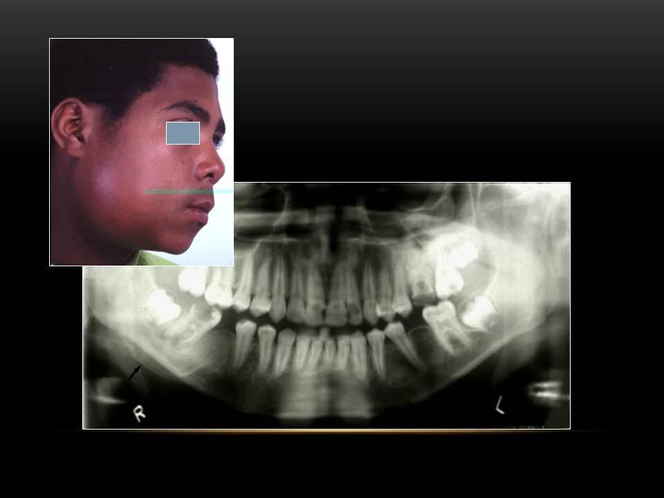 Dentistry Radiographic Image Selection Criteria