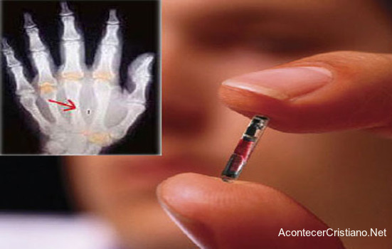 Implante de microchip en niños
