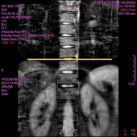 horas de pista de dolor perineal horas de pista de dolor perineal
