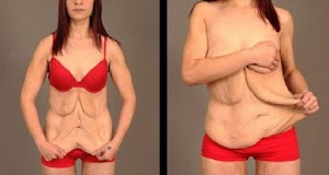 Elle a perdu 89 kg en 18 mois en éliminant une seule chose dans son régime alimentaire