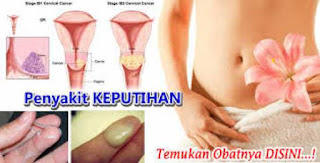 obat keputihan terus-menerus paling ampuh di apotik