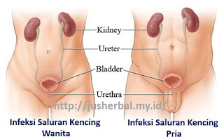 obat penis nyeri sakit keluar lendir nanah yang ampuh di apotik