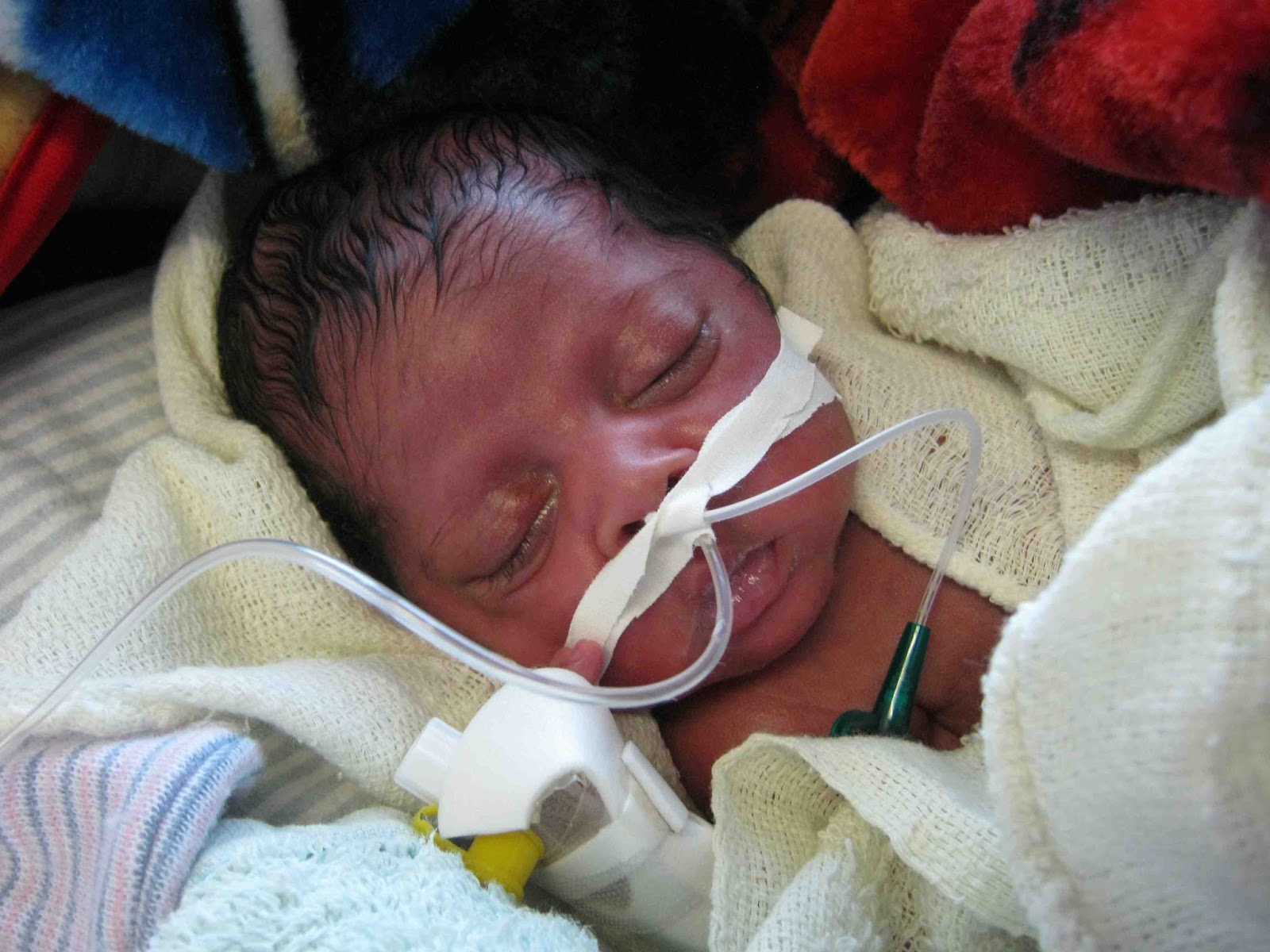 Dokta Steph goes to PNG Low birth weight week